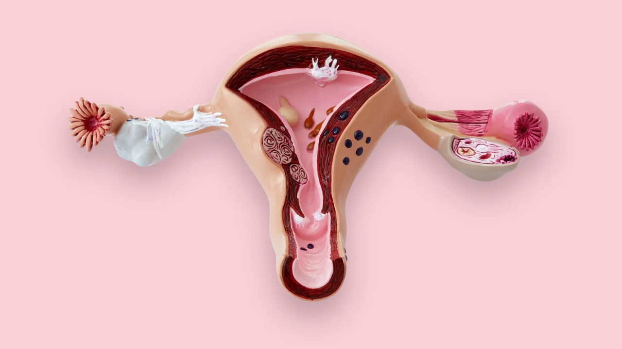 Uterine Prolapse: Symptoms, Causes and Treatment - Nona Woman - Nona Woman