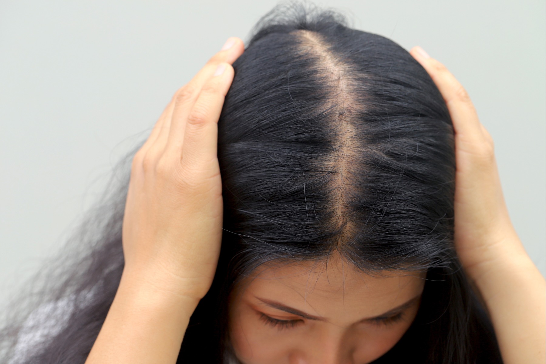 Kenapa Rambut Rontok Saat Haid? Memahami Keterkaitannya